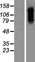 PBXIP1 / HPIP Protein - Western validation with an anti-DDK antibody * L: Control HEK293 lysate R: Over-expression lysate
