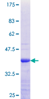 PBXIP1 / HPIP Protein - 12.5% SDS-PAGE Stained with Coomassie Blue.