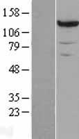 PC / Pyruvate Carboxylase Protein - Western validation with an anti-DDK antibody * L: Control HEK293 lysate R: Over-expression lysate