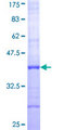 PC / Pyruvate Carboxylase Protein - 12.5% SDS-PAGE Stained with Coomassie Blue.