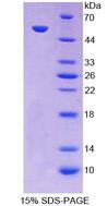 PC / Pyruvate Carboxylase Protein - Recombinant  Pyruvate Carboxylase By SDS-PAGE