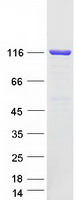 PC / Pyruvate Carboxylase Protein - Purified recombinant protein PC was analyzed by SDS-PAGE gel and Coomassie Blue Staining