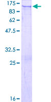 PC5 / PCSK5 Protein - 12.5% SDS-PAGE of human PCSK5 stained with Coomassie Blue