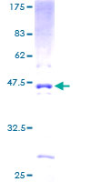 PCA1 / ALKBH3 Protein - 12.5% SDS-PAGE of human DEPC-1 stained with Coomassie Blue