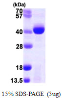 PCA1 / ALKBH3 Protein