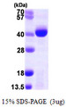 PCA1 / ALKBH3 Protein