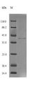 PCBD1 / PHS Protein - (Tris-Glycine gel) Discontinuous SDS-PAGE (reduced) with 5% enrichment gel and 15% separation gel.