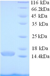 PCBD1 / PHS Protein
