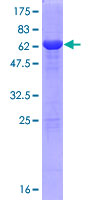 PCBP3 Protein - 12.5% SDS-PAGE of human PCBP3 stained with Coomassie Blue