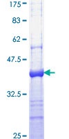 PCBP4 Protein - 12.5% SDS-PAGE Stained with Coomassie Blue.