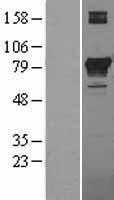 PCCA Protein - Western validation with an anti-DDK antibody * L: Control HEK293 lysate R: Over-expression lysate