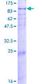 PCCA Protein - 12.5% SDS-PAGE of human PCCA stained with Coomassie Blue