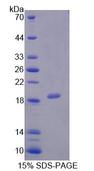 PCCA Protein - Recombinant Propionyl Coenzyme A Carboxylase Alpha (PCCa) by SDS-PAGE