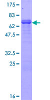 PCDH1 / PCD1 Protein - 12.5% SDS-PAGE of human PCDH1 stained with Coomassie Blue