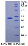 PCDH1 / PCD1 Protein - Recombinant Protocadherin 1 By SDS-PAGE
