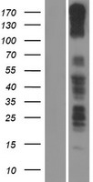 PCDH11X / Protocadherin 11 Protein - Western validation with an anti-DDK antibody * L: Control HEK293 lysate R: Over-expression lysate