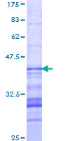 PCDH11X / Protocadherin 11 Protein - 12.5% SDS-PAGE Stained with Coomassie Blue.