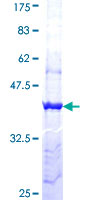 PCDH11Y / Protocadherin Y Protein - 12.5% SDS-PAGE Stained with Coomassie Blue.