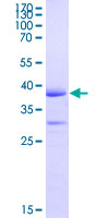 PCDH19 / Protocadherin 19 Protein - 12.5% SDS-PAGE Stained with Coomassie Blue.