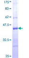 PCDH20 Protein - 12.5% SDS-PAGE Stained with Coomassie Blue.