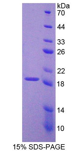 PCDH20 Protein - Recombinant  Protocadherin 20 By SDS-PAGE