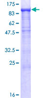 PCDH21 / Protocadherin 21 Protein - 12.5% SDS-PAGE of human PCDH21 stained with Coomassie Blue