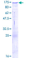 PCDH8 Protein - 12.5% SDS-PAGE of human PCDH8 stained with Coomassie Blue