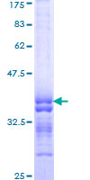 PCDHA11 Protein - 12.5% SDS-PAGE Stained with Coomassie Blue.
