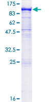 PCDHA2 Protein - 12.5% SDS-PAGE of human PCDHA2 stained with Coomassie Blue