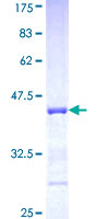 PCDHA5 Protein - 12.5% SDS-PAGE Stained with Coomassie Blue.