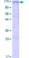 PCDHA6 Protein - 12.5% SDS-PAGE of human PCDHA6 stained with Coomassie Blue
