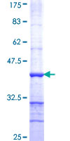 PCDHA9 Protein - 12.5% SDS-PAGE Stained with Coomassie Blue.