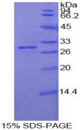 PCDHB2 / Protocadherin Beta 2 Protein - Recombinant Protocadherin Beta 2 By SDS-PAGE