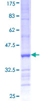 PCDHB6 Protein - 12.5% SDS-PAGE Stained with Coomassie Blue.
