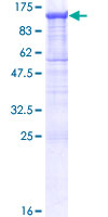 PCDHGA11 Protein - 12.5% SDS-PAGE of human PCDHGA11 stained with Coomassie Blue