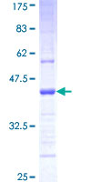 PCDHGA2 Protein - 12.5% SDS-PAGE Stained with Coomassie Blue.