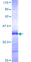PCDHGA5 Protein - 12.5% SDS-PAGE Stained with Coomassie Blue.