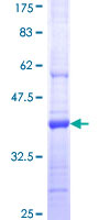 PCDHGA9 Protein - 12.5% SDS-PAGE Stained with Coomassie Blue.