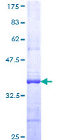 PCDHGB5 Protein - 12.5% SDS-PAGE Stained with Coomassie Blue.