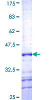 PCDHGB6 Protein - 12.5% SDS-PAGE Stained with Coomassie Blue.