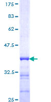 PCDHGB7 Protein - 12.5% SDS-PAGE Stained with Coomassie Blue.