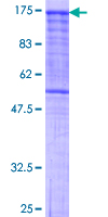 PCDHGC3 / PCDH2 Protein - 12.5% SDS-PAGE of human PCDHGC3 stained with Coomassie Blue