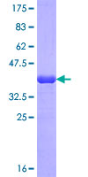 PCF11 Protein - 12.5% SDS-PAGE Stained with Coomassie Blue.