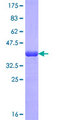 PCF11 Protein - 12.5% SDS-PAGE Stained with Coomassie Blue.