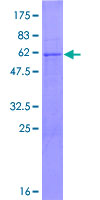 PCGF3 Protein - 12.5% SDS-PAGE of human PCGF3 stained with Coomassie Blue
