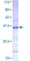 PCGF3 Protein - 12.5% SDS-PAGE Stained with Coomassie Blue.