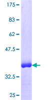 PCGF5 Protein - 12.5% SDS-PAGE Stained with Coomassie Blue.