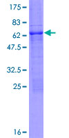 PCGF6 Protein - 12.5% SDS-PAGE of human PCGF6 stained with Coomassie Blue
