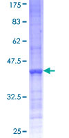 PCGF6 Protein - 12.5% SDS-PAGE Stained with Coomassie Blue.