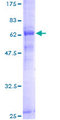 PCID2 Protein - 12.5% SDS-PAGE of human FLJ11305 stained with Coomassie Blue